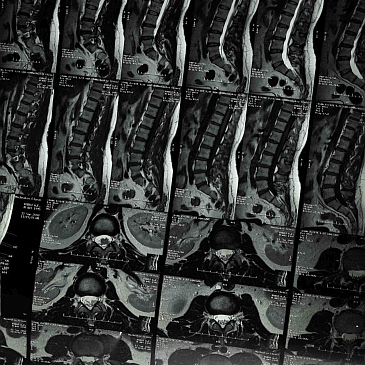 Monochrome x-ray film